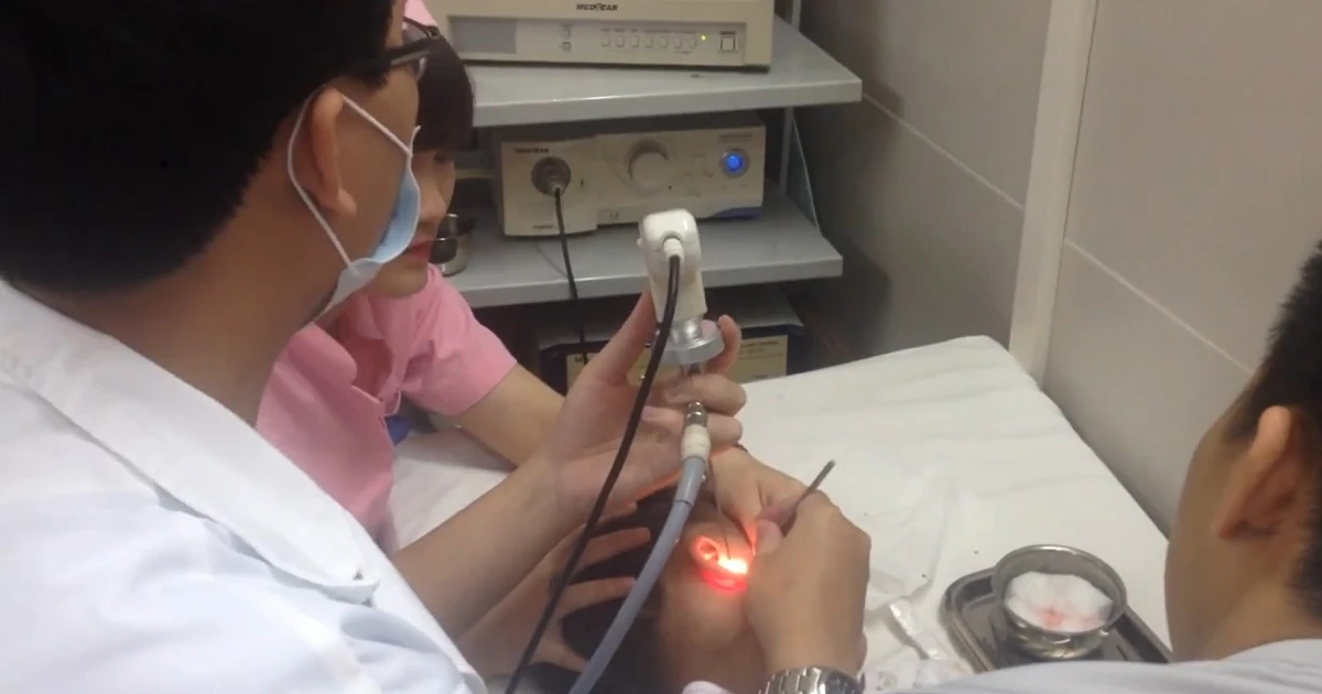 Thủng màng nhĩ ở trẻ: Hiểm họa từ thói quen tưởng như vô hại