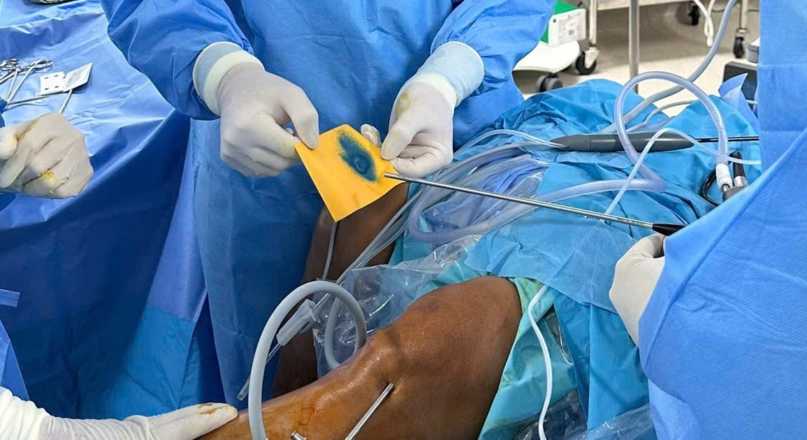 Điều trị thành công thoái hóa khớp bằng phương pháp hoàn toàn mới