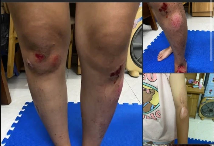 Công an xác minh thông tin vụ 2 cô gái bị đánh sau va chạm giao thông