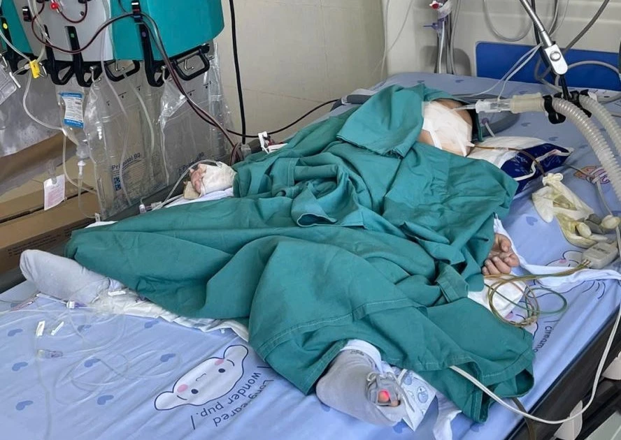 Nuốt nhầm hóa chất thí nghiệm, bé 2 tuổi nhập viện lọc máu