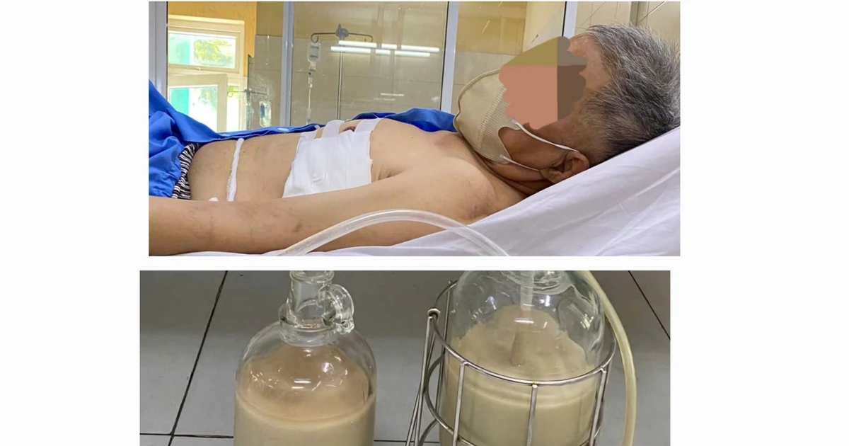 Hút ra hàng lít mủ từ phổi người đàn ông ở Đà Nẵng