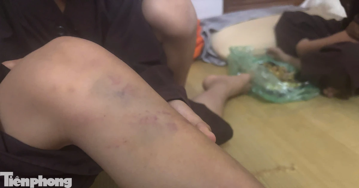 Vụ bạo hành trẻ tại chùa Bầu, Phú Thọ: Nhiều cháu có thương tích