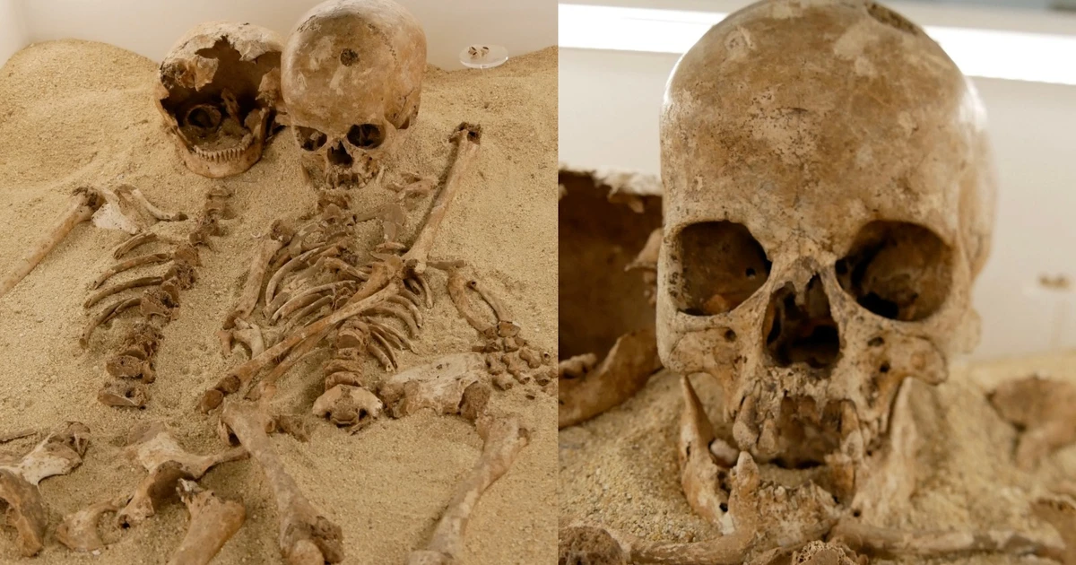 Bệnh lùn hiếm gặp bất ngờ được phát hiện từ hài cốt cách đây 12.000 năm tại Ý