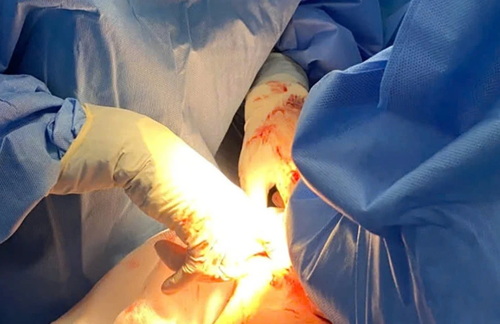 Mẹ con thai phụ lâm nguy vì bệnh nguy hiểm dễ nhầm với thai nghén