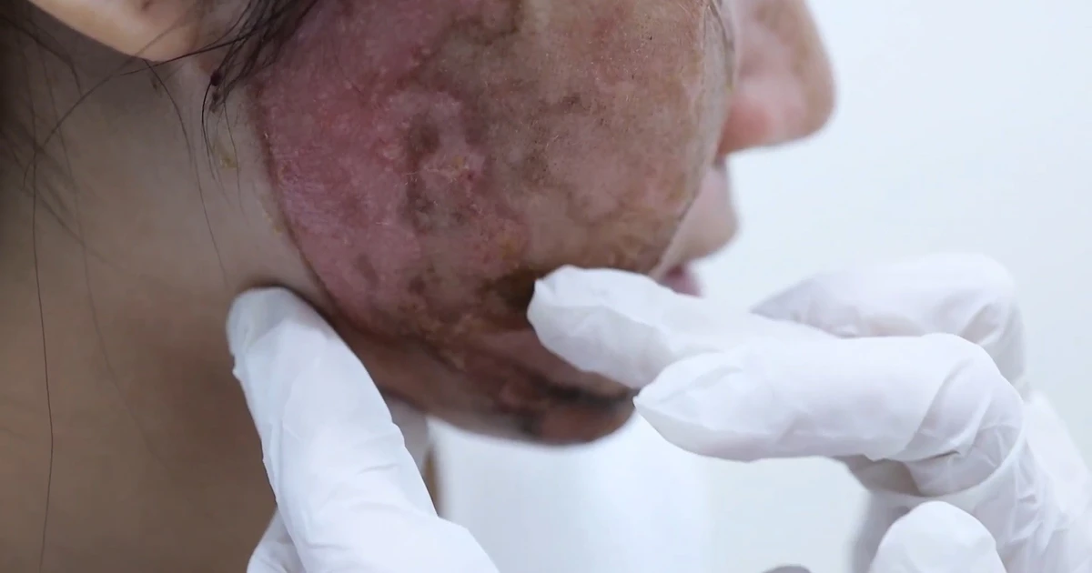 TP.HCM truy quét mỹ phẩm dỏm, thẩm mỹ 'chui'