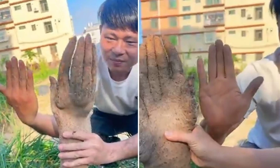 Bác nông dân đào được củ khoai hình bàn tay: Là hiện tượng gì, vì sao xảy ra?