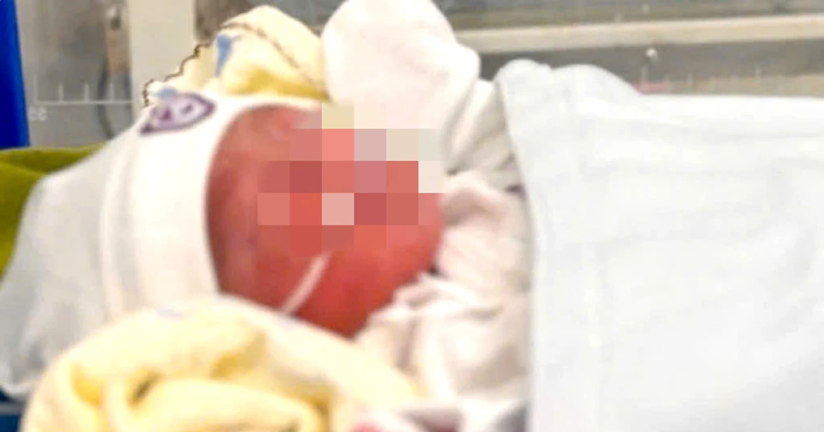 Gia Lai: Tìm người thân bé gái sơ sinh bọc trong túi nilon ở cầu treo