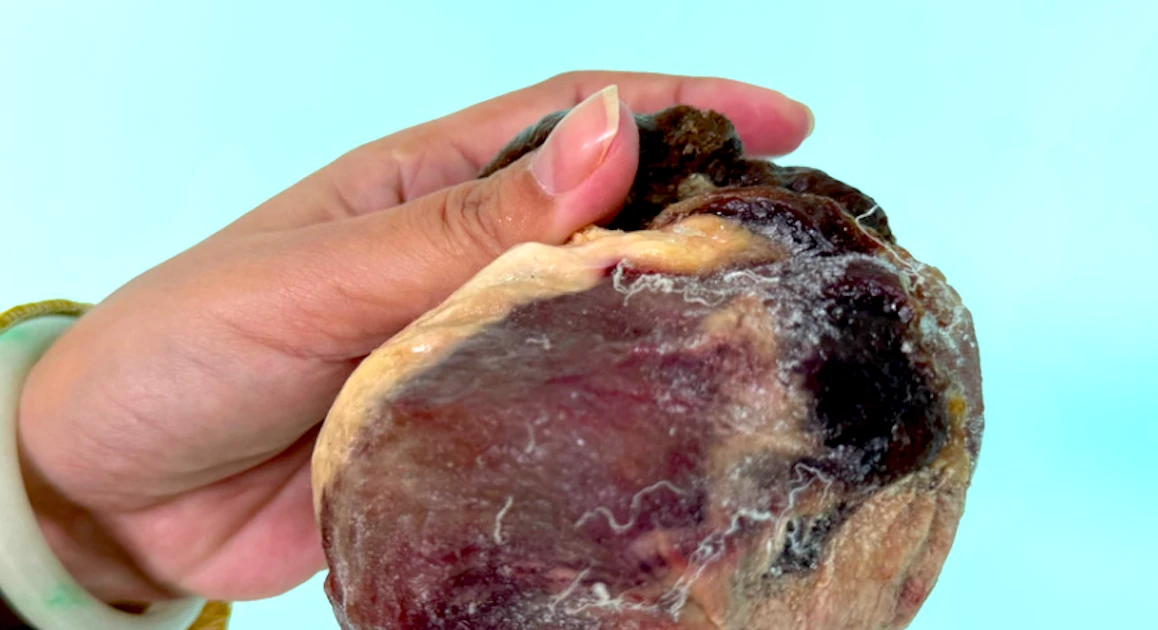 Mổ thịt con bò chỉ ngủ đứng, phát hiện vật thể nghi là ngưu hoàng quý hiếm