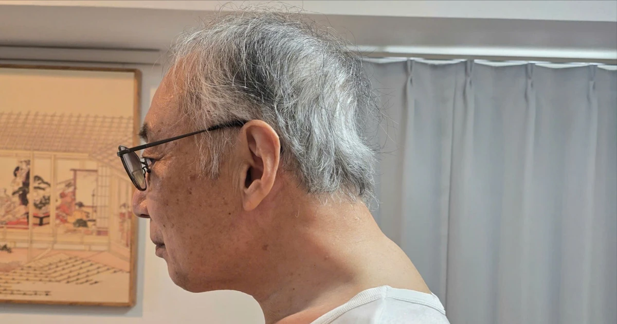 Không thể xoay ngửa cổ vì bệnh hiếm, giáo sư người Nhật sang Việt Nam phẫu thuật thành công