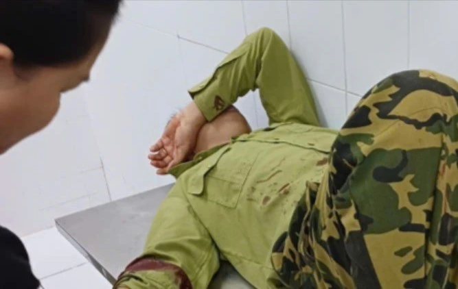 Truy đuổi đối tượng nghi vấn, nhân viên bảo vệ rừng bị chém thương tích