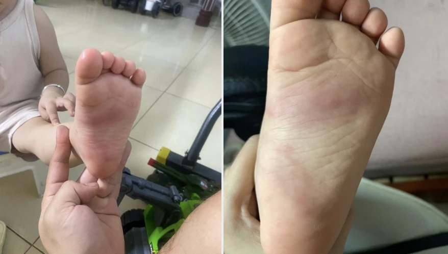 Xác minh thông tin bé trai 3 tuổi nghi bị giáo viên bạo hành ở Hưng Yên