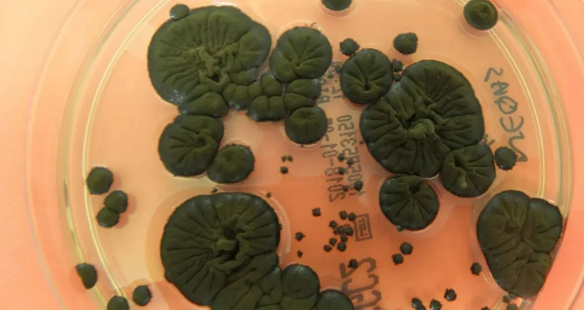 Loài nấm sinh sôi ở ‘vùng chết’ có thể bảo vệ phi hành gia