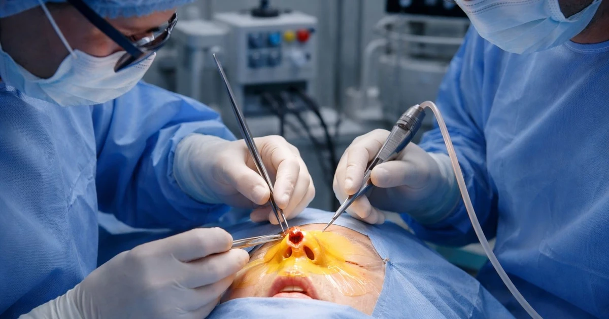 Phẫu thuật phục hồi thành công ca biến chứng sau nâng mũi bằng silicon