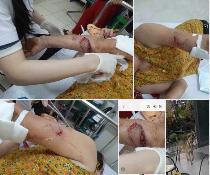 Chó lạ hung hãn tấn công 3 phụ nữ đi tập thể dục