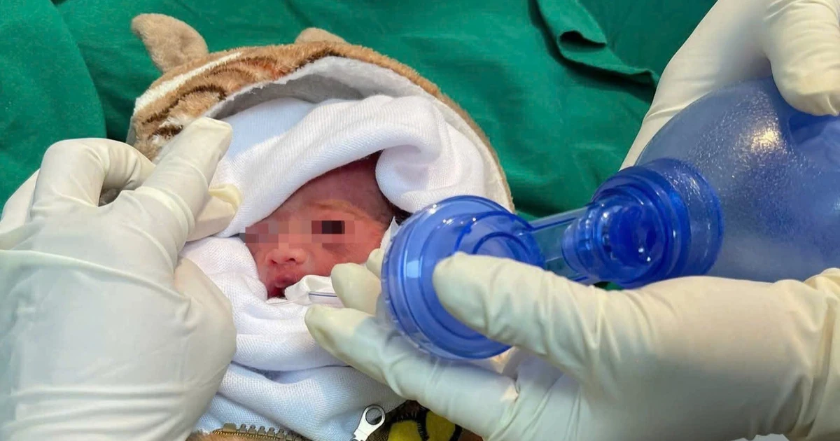 Giành giật sự sống cho trẻ sinh non chỉ nặng 900 gram