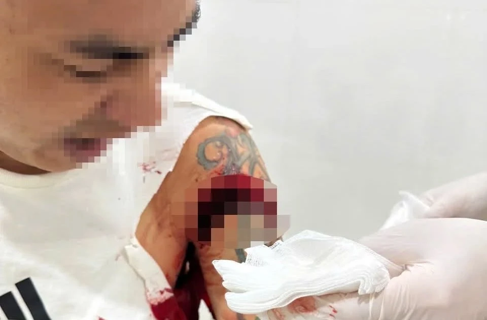 Người đàn ông bị chém trọng thương khi đang ngồi uống cà phê