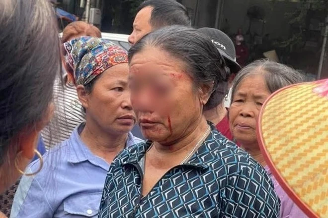 Tranh chấp chỗ bán hàng, một phụ nữ bị xịt nước cao áp đến chảy máu mắt