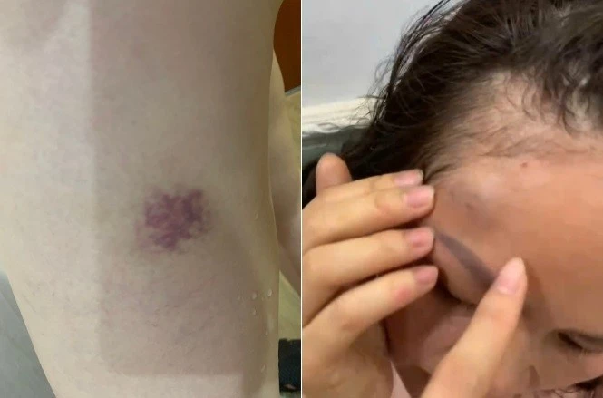 Hà Nội: Công an vào cuộc vụ một gia đình tố bị hàng xóm liên tục đe dọa, hành hung