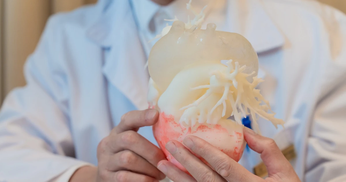 Ca thay van động mạch chủ qua da đầu tiên tại Việt Nam ứng dụng công nghệ in 3D cá thể hóa