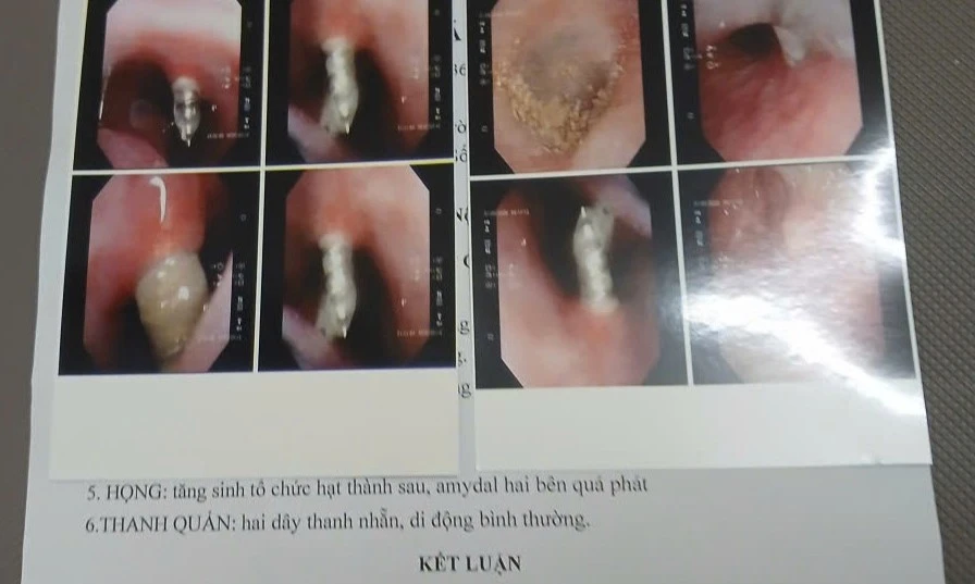 Vụ niềng răng bị thủng xoang mũi: Lập hội đồng chuyên môn rà soát quy trình