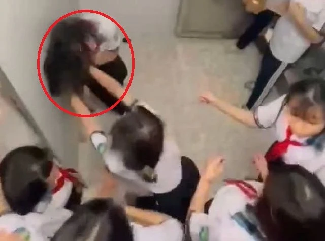 Vụ nữ sinh lớp 8 bị đánh hội đồng trong nhà vệ sinh: Rạn 3 xương sườn