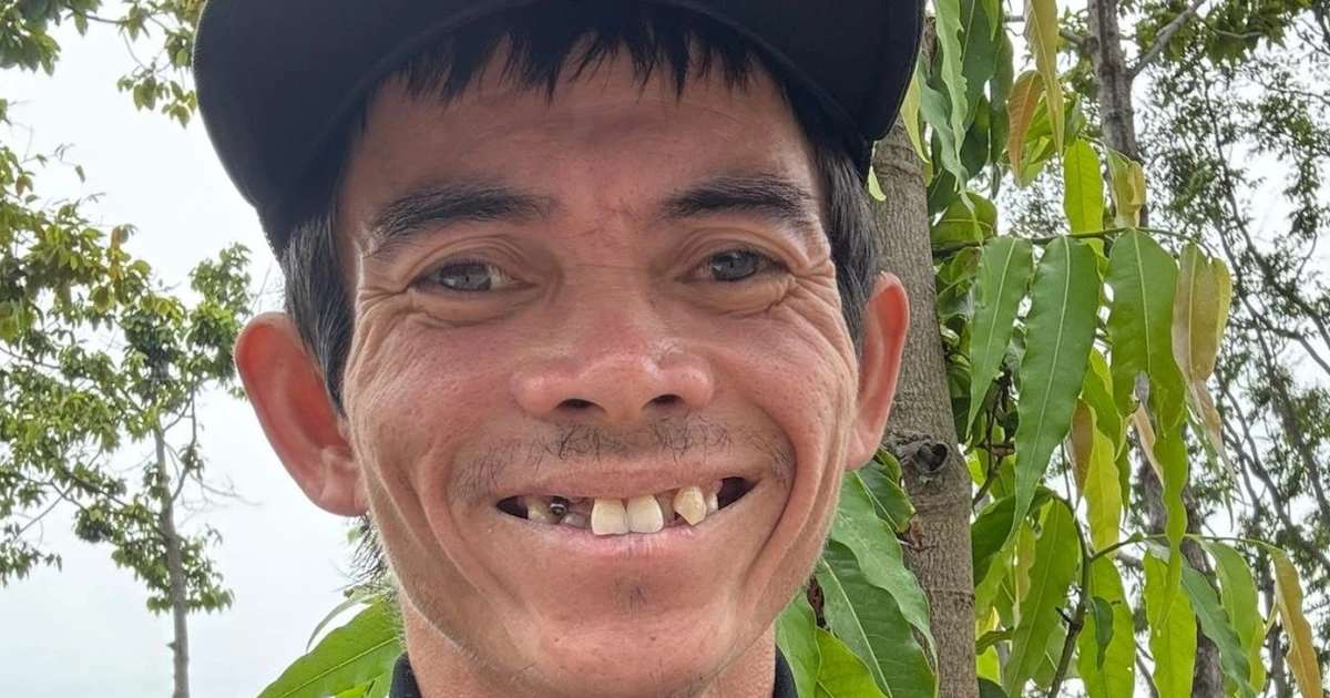 Tình trạng chàng trai chăn bò từng nổi tiếng toàn cầu