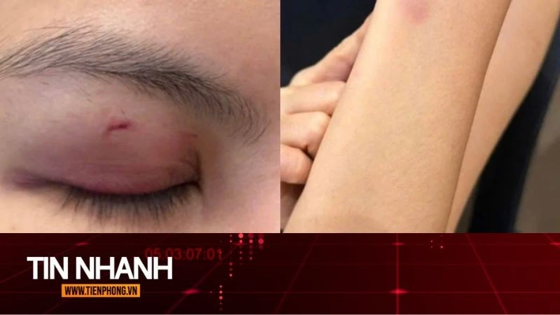 TIN NHANH: Luật sư nhận định vụ ca sĩ Trung Quân Idol bị tố đánh phụ nữ