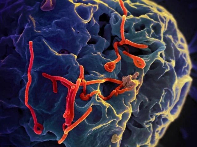 Dịch Ebola diễn biến phức tạp, Bộ Y tế họp khẩn