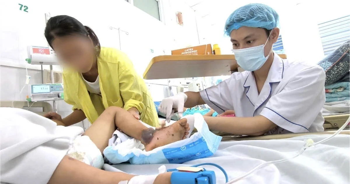 Bé trai 4 tuổi nguy kịch vì bà nội cho đắp thuốc nam chữa vết mèo cắn