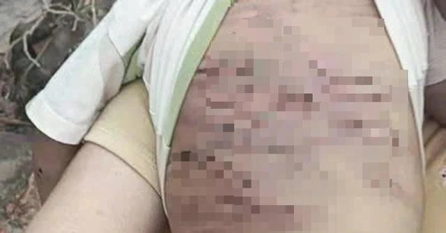 Liên tiếp các vụ bạo hành trẻ em, Bộ Y tế vào cuộc