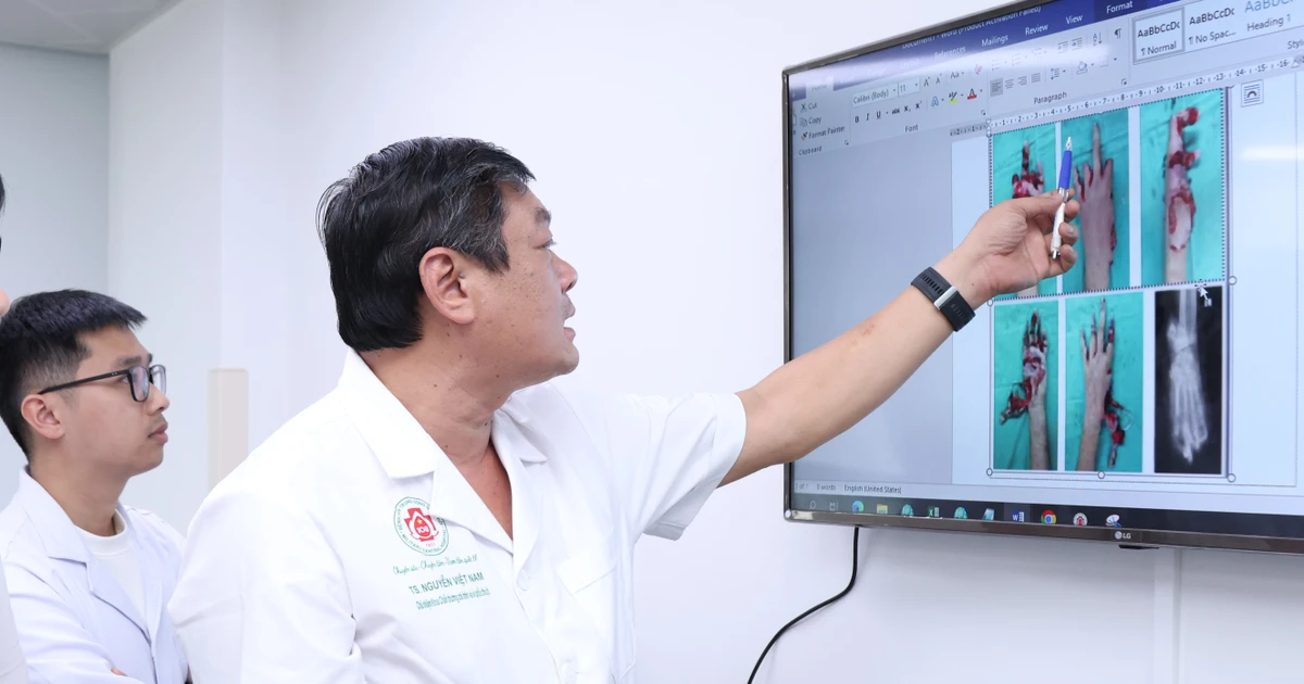 Thiếu niên 15 tuổi dập nát toàn bộ bàn tay vì pháo nổ