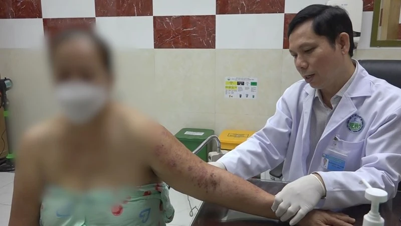 Zona thần kinh tiềm ẩn nhiều biến chứng nghiêm trọng