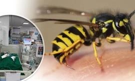 Bé gái 9 tuổi nguy kịch vì bị đàn ong vò vẽ đốt hơn 50 nốt