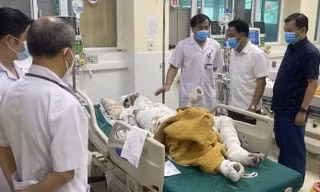 3 người bị bỏng rất nặng khi chữa cháy rừng ở Điện Biên