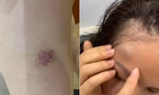 Hà Nội: Công an vào cuộc vụ một gia đình tố bị hàng xóm liên tục đe dọa, hành hung