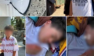 Công an vào cuộc vụ học sinh lớp 6 bị đánh hội đồng ở Nha Trang