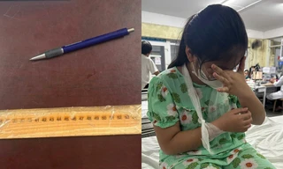 Thực hư vụ việc cô giáo ở Huế "đánh gãy tay" học sinh lớp 4