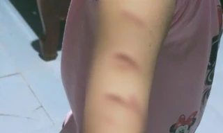 Toàn cảnh vụ nữ sinh lớp 5 ở Cà Mau bị chị họ học cùng lớp rạch tay