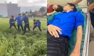 Hải Phòng: Nam sinh lớp 11 bị nhóm bạn đánh gãy xương mũi, phải nhập viện điều trị