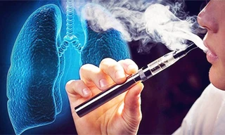 Sắp tới, người sử dụng thuốc lá điện tử có thể bị xử phạt lên tới 10 triệu đồng