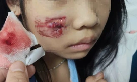 Cháu bé bị khỉ hoang tấn công khi chơi ở sân nhà