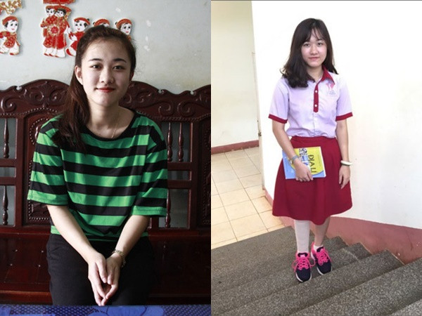 “Nữ sinh bị cưa chân” đậu ĐH Luật TPHCM