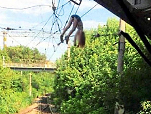 Ngã xuống đây điện cao thế 3.000 volt nhưng vẫn sống sót kỳ diệu