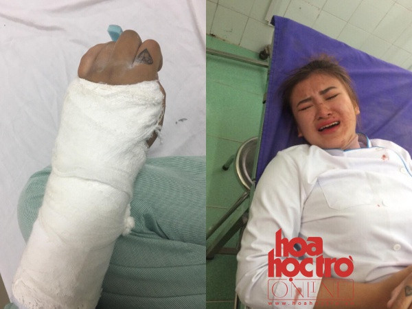 Quảng Ninh: Mâu thuẫn với bạn cùng lớp, teen bị đánh gãy tay, dập sống mũi