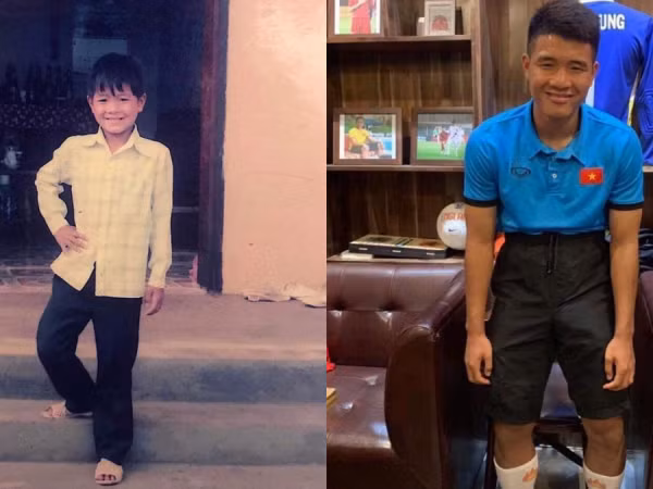 Đức Chinh khoe ảnh #10YearsChallenge, người hâm mộ tròn mắt hỏi: "Dậy thì chưa vậy?"