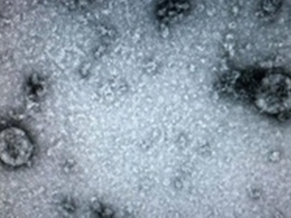 Virus corona có thể sống trong cơ thể một tháng