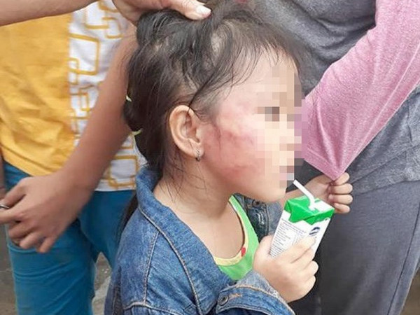 Cùng tuyên truyền, nâng cao nhận thức giáo dục và bảo vệ trẻ em cho cộng đồng