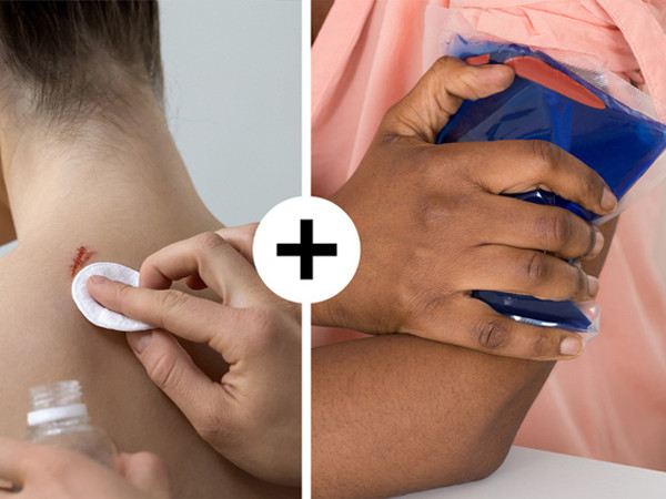 Một vài mẹo sơ cứu ban đầu bạn nên biết