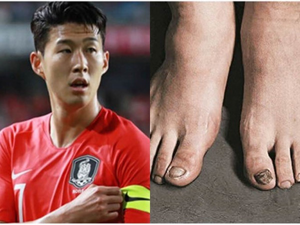 Son Heung-Min và hệ quả cho suất miễn nghĩa vụ quân sự Hàn Quốc