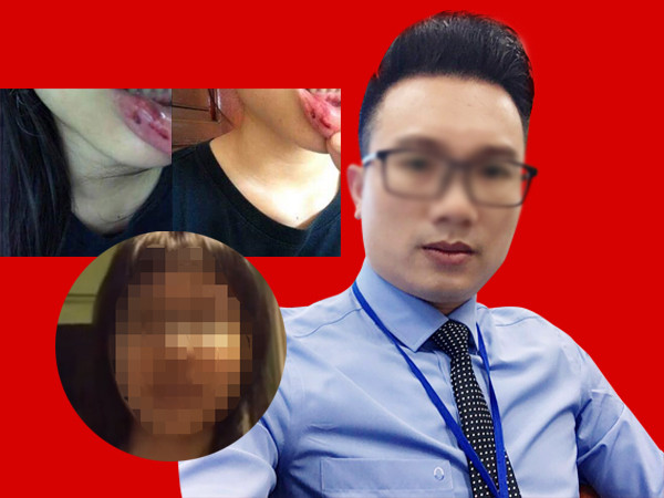 Bố của nữ sinh tố bị bạo hành: "Làm cha mẹ, tôi không nên để xảy ra việc này!"